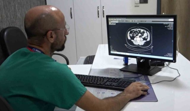 Uzmanlar vatandaşları kolon kanserine karşı uyardı